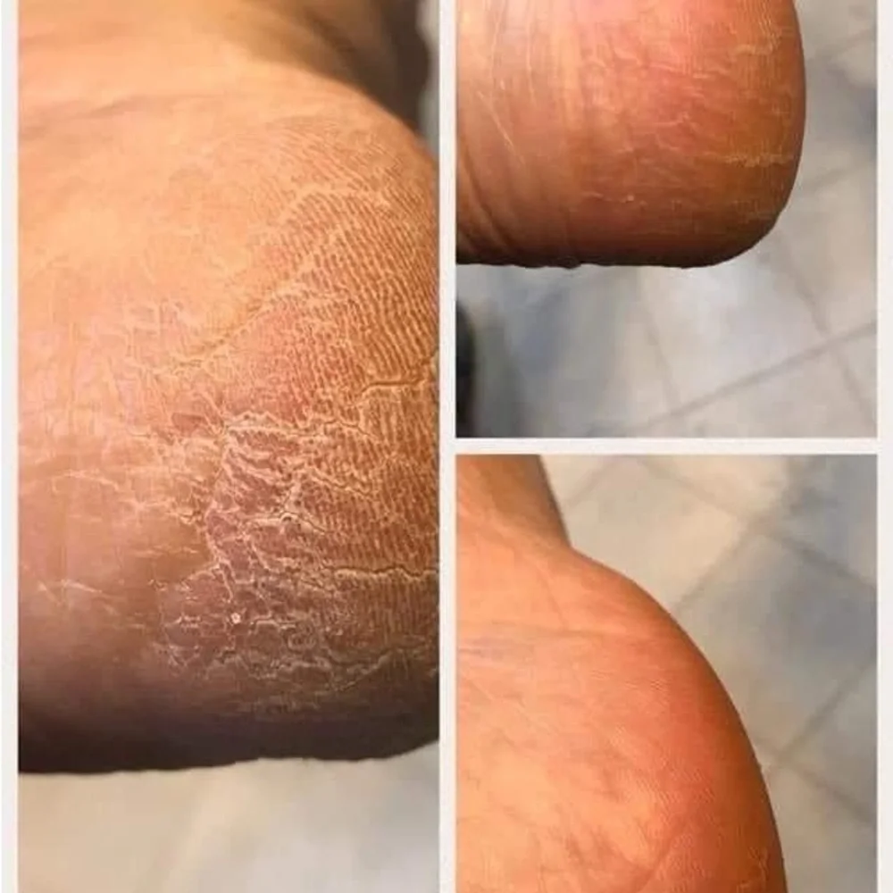 Pedicure in a bottle - Picture 3 of 9